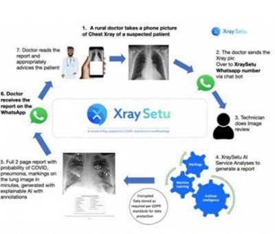 AI-driven ‘XraySetu’ to facilitate early COVID interventions