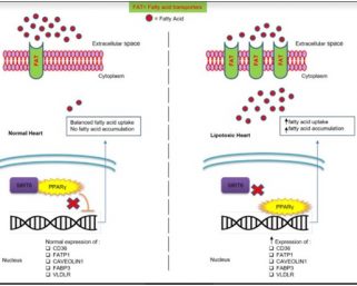 Study could help unravel mystery of fatty acid accumulation in heart